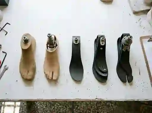 Five prosthetic feet from SACH to carbon fibre