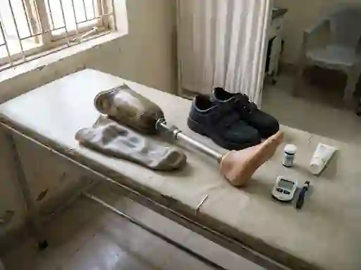 Prosthetic leg with a gel liner beside diabetic shoes